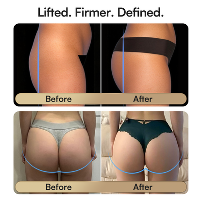 ZILARTA CURVIFY EMS Toning Shorts